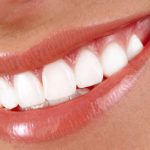 teeth-whitening-mallonee