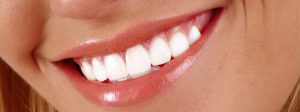 teeth-whitening-mallonee